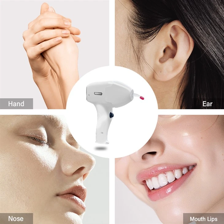 High-performance Diode Laser Hair Removal Machine