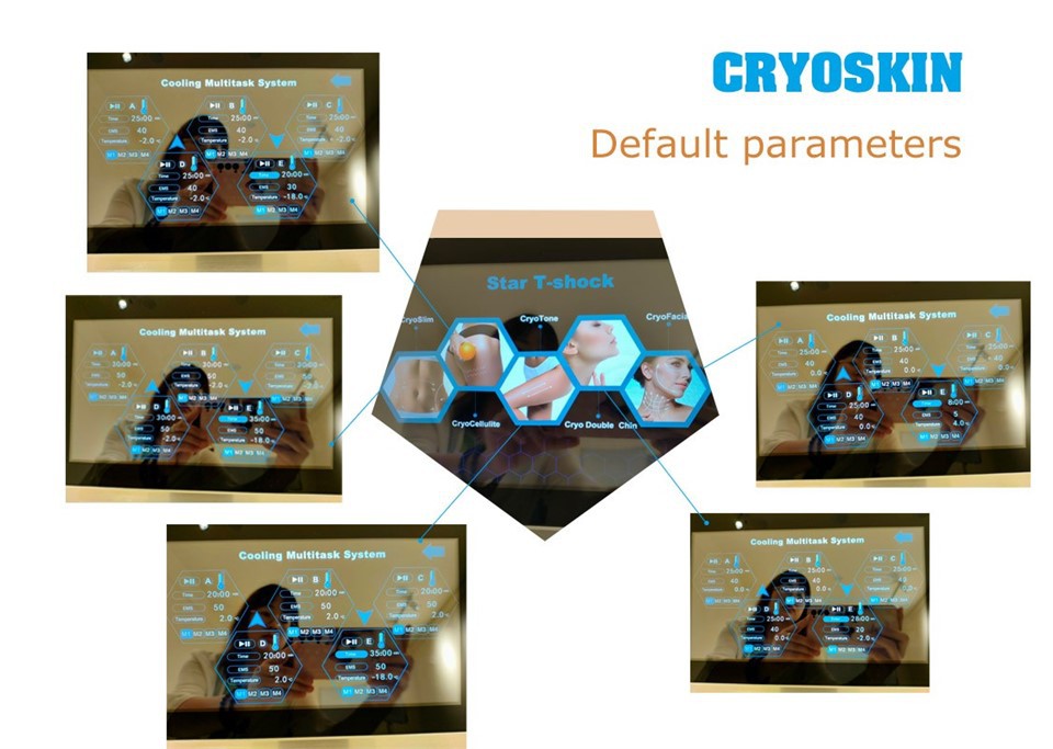 Star T-shock Machine high quality